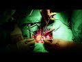 Open Heart Surgery: Aortic Valve Replacement from a Medical Student’s Perspective