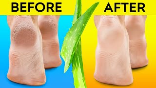 Benefits Of Aloe Vera And Skincare Routines You Must Know