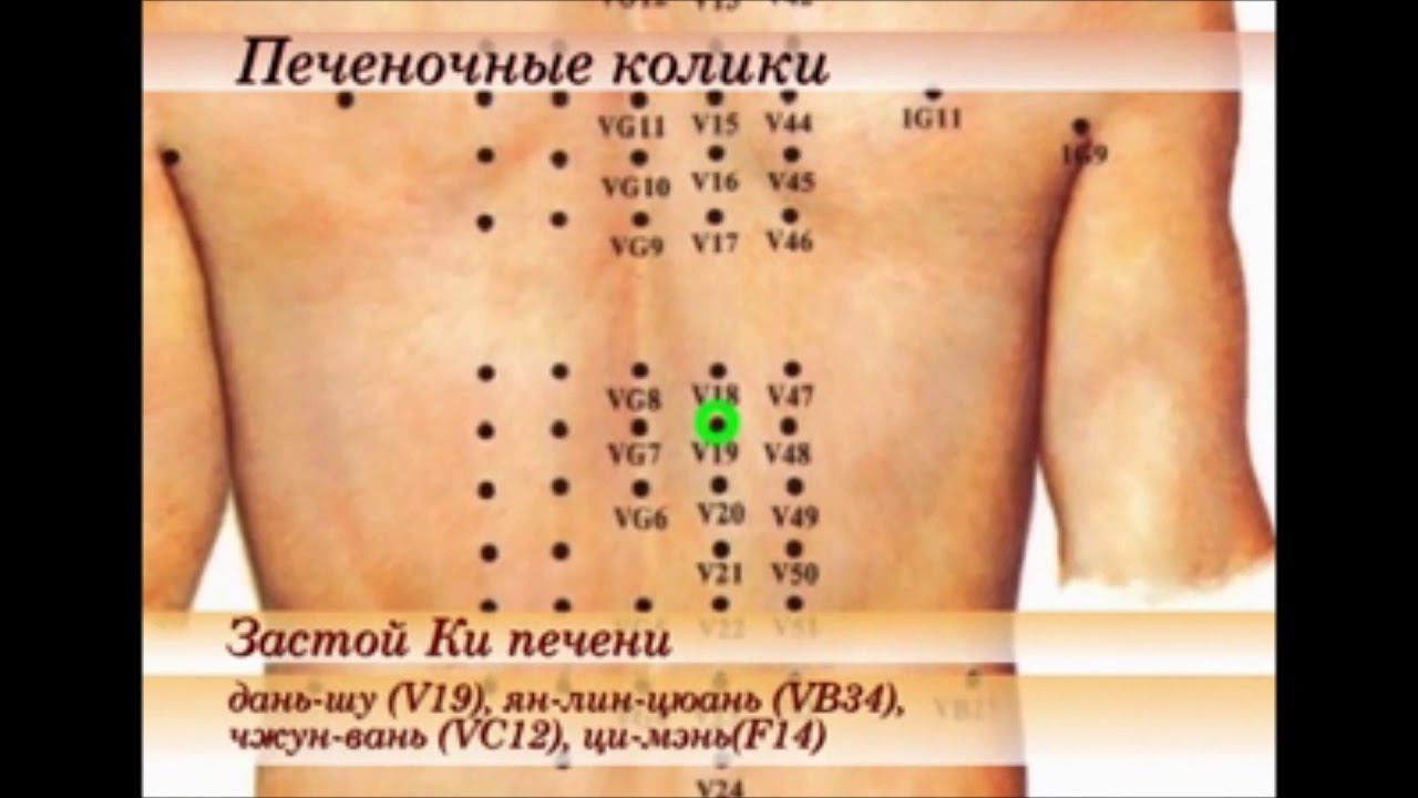 Если печеночные колики(секрет исюэтуна) - YouTube