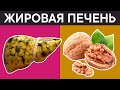 Накопление ЖИРОВ В ПЕЧЕНИ. Мне помогли эти методы и продукты для ОЧИЩЕНИЯ ПЕЧЕНИ от ЖИРОВ