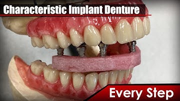 Learn How To Make Characteristic Implant Denture Prototype