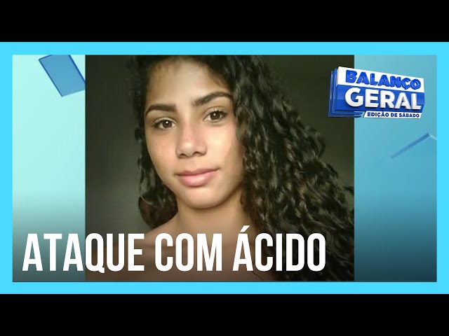 Mãe de jovem que foi atacada com ácido fala sobre o caso class=