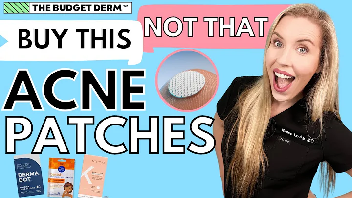 Buy This Not That: Acne Patches | Part 4 by The Budget Dermatologist