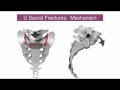 Sacral fractures - classifications and indications