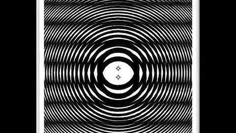 Moire Pattern of Two Fresnel Zone Plates