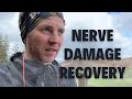 Nerve damage isnt ideal for a runner