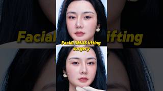 #Facial Fascia Lift# Create a More Beautiful You—Look 20 Years Younger