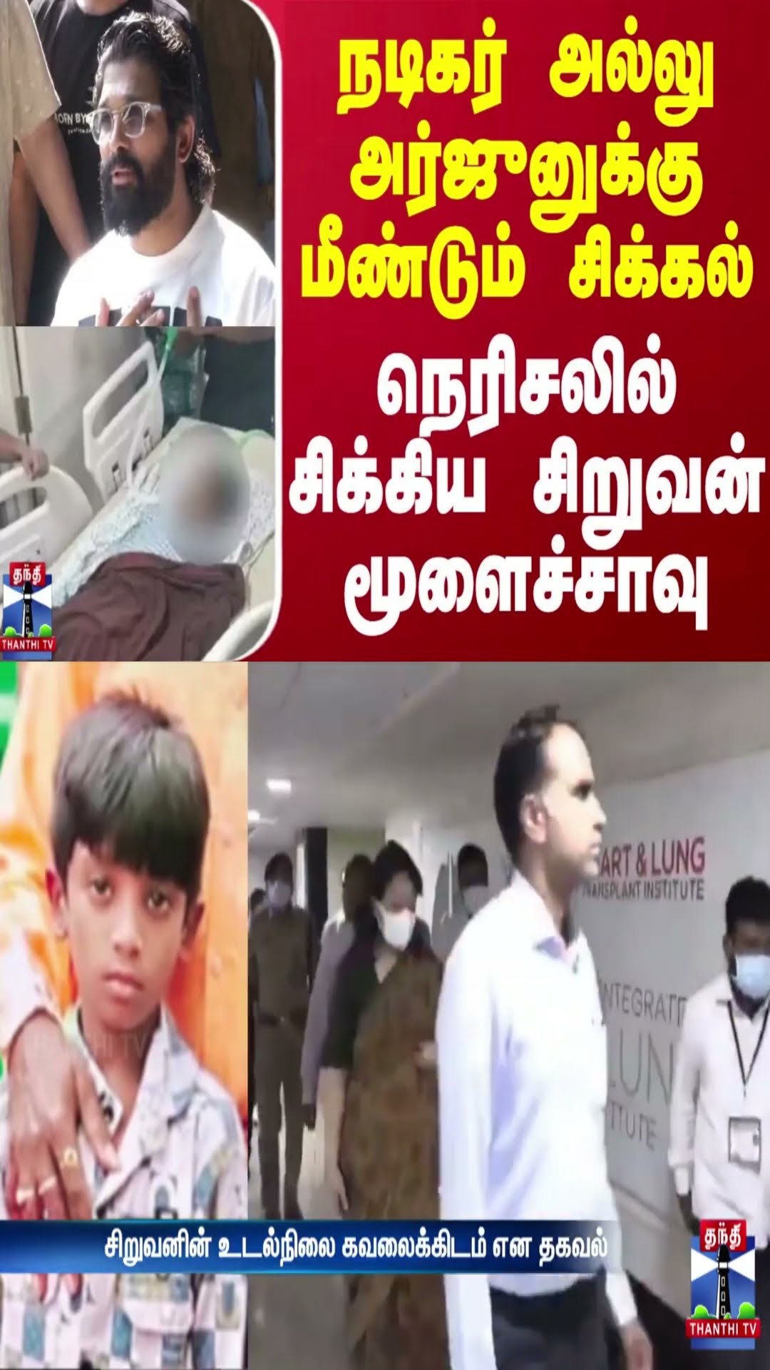நடிகர் அல்லு அர்ஜுனுக்கு மீண்டும் சிக்கல் -  நெரிசலில் சிக்கிய சிறுவன் மூளைச்சாவு