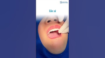 Chị Diễm từ Hawaii đã làm răng sứ tại Nha khoa Tường Minh🌟 #nhakhoatuongminh #rangsuthammy #shorts