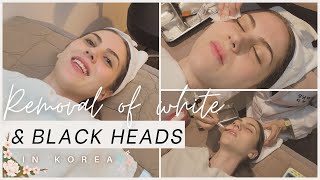 Glass Skin Treatment: Removal of Blackheads and Whiteheads In Korea