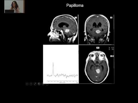 MRI spektroskopija MRS, Jelena Ostojic 1_04