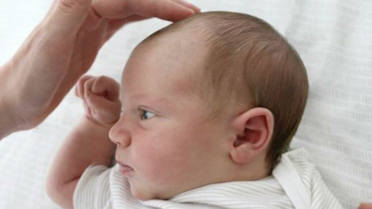 رأس الشمامه | أعراض لحديثي الولادة تقلق منها الأمهات بلا داعٍ
