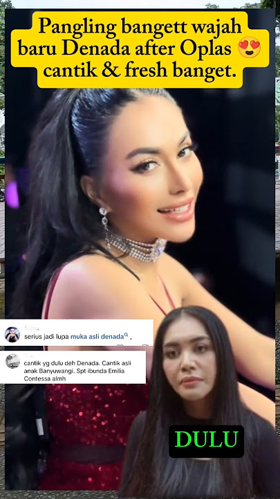 Kalian lebih suka wajah Denada dulu atau sekarang guys #denada #oplashidung #artisoplas