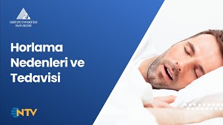 Horlama Nedenleri ve Tedavisi | Dr. Öğr. Ü. Seha Akduman