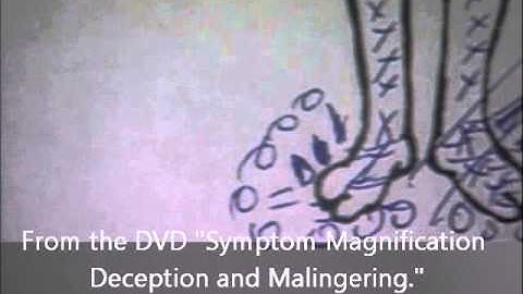 How to Interpret a Pain Inventory used in an Independent Medical Evaluation   IME