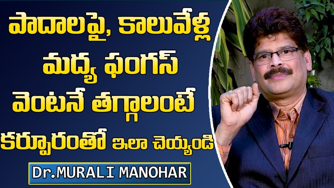 పాదాలపై ఇంకా కాళ్ల వేళ్ళ మధ్యలో ఫంగస్ పోవాలంటే కర్పూరంతో ఇలా రోజూ చెయ్యండి||Athlete Foot -Dr.Manohar