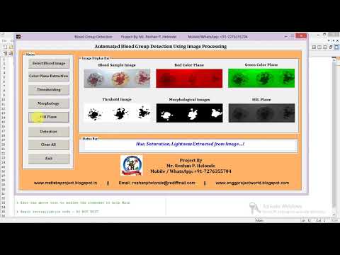 Matlab Code for Blood Group Detection and Classification Using Image Processing