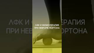 ЛФК ПРИ ЛЕЧЕНИИ НЕВРОМЫ МОРТОНА.