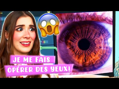 LASIK MYOPIA Surgery 😱 FAQ + VIDEOS of the operation