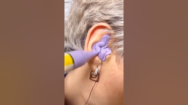 This Man used to wear earphones for eight hours every day😱 #shorts