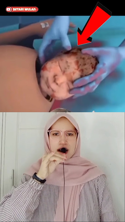 ILLUSTRATION OF A MOTHER GIVING BIRTH ⁉️ALL THE CHILDREN CRY WATCHING THIS VIDEO #shorts #mother