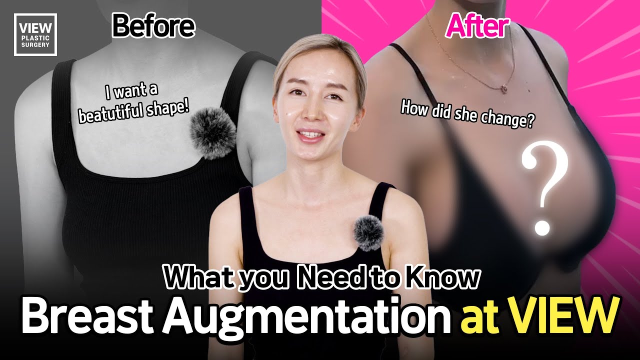 Breast Augmentation at VIEW: What You Need to Know