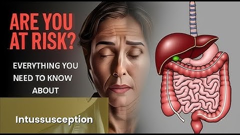 Intussusception Explained Causes, Symptoms and Treatment, All Insights