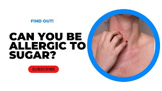 Can You be Allergic to Sugar? [FIND OUT]