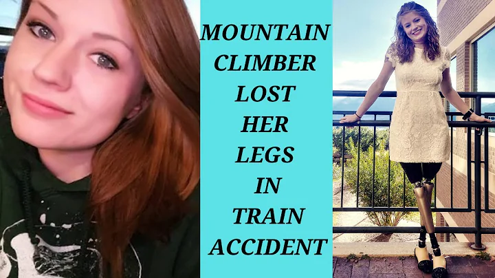 Woman Lost Legs In Train Accident Gets New Prosthe...
