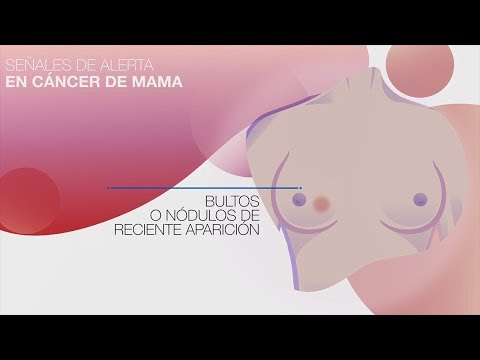 Video: 3 formas de diagnosticar la enfermedad mamaria masculina