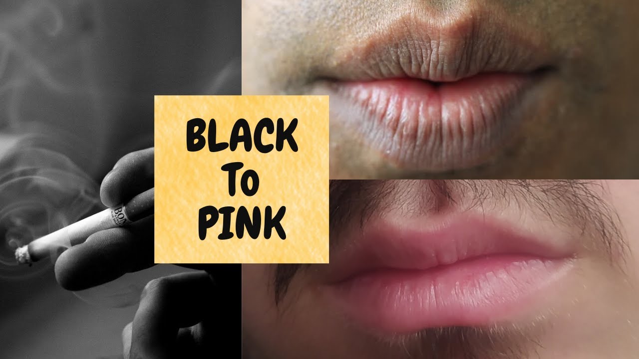 Black Lips to Pink lips কালো ঠোঁট গোলাপি করার উপায় Smoker lips