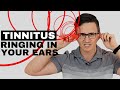 How To Get Rid of Tinnitus (Cervical) / Ringing in Ears
