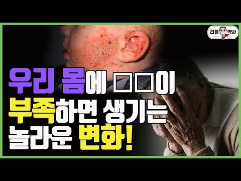 오메가3추천