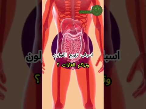 عادات تتسبب فى تهيج القولون وتراكم الغازات القولون تهيج القولون تنظيف تنظيف القولون صحه صحية
