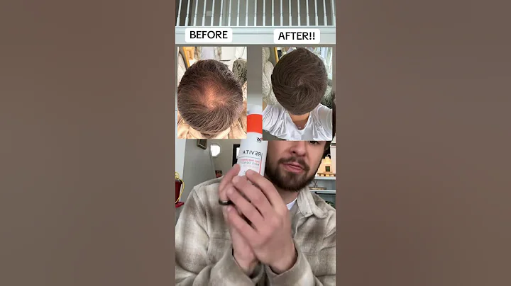 Revita Shampoo Helps Regrow Hair! #hairlosssolutions