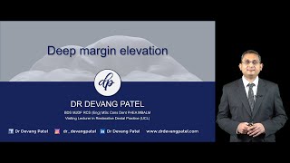 Deep Margin Elevation