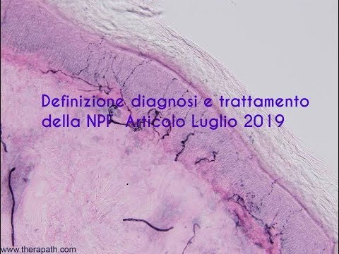 Definizione, diagnosi e trattamento della neuropatia delle piccole fibre (Luglio 2019) - 1° parte