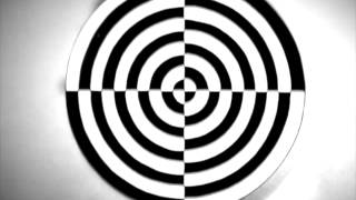 Vertigo