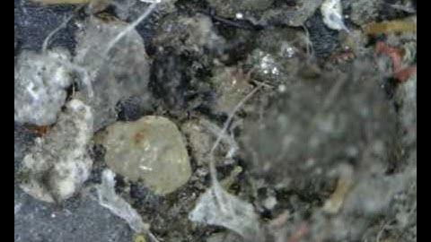 Dino-Lite Handheld Digital Microscope Dustmites3