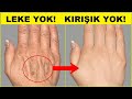 Denenmiş | EL LEKELERİNİ NASIL YOK ETTİM? ELDEKİ KIRIŞIKLIK NASIL GİDERİLİR? EL BAKIMI