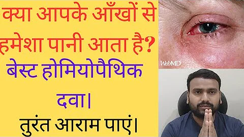 #Lachrymation#आँखों से पानी आना#Watery Eye#आँखों से पानी आने की बेस्ट Homeopathic Medicine ।