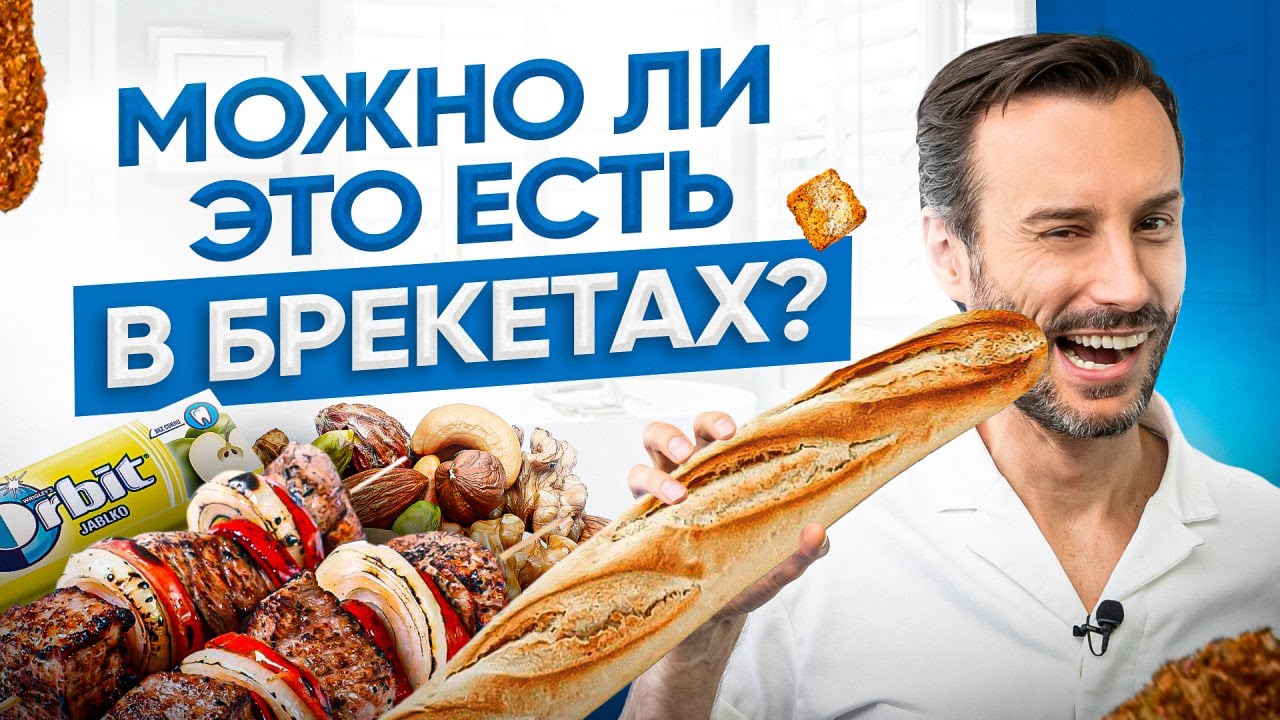 Мифы о продуктах, которые нельзя есть с брекетами