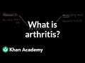 Understanding Arthritis