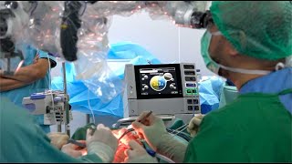 Tindakan Operasi Pada Kasus Brain Cyst atau Kista Otak di Edelweiss Hospital