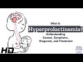 Hyperprolactinemia Unraveled: The Root Causes Revealed