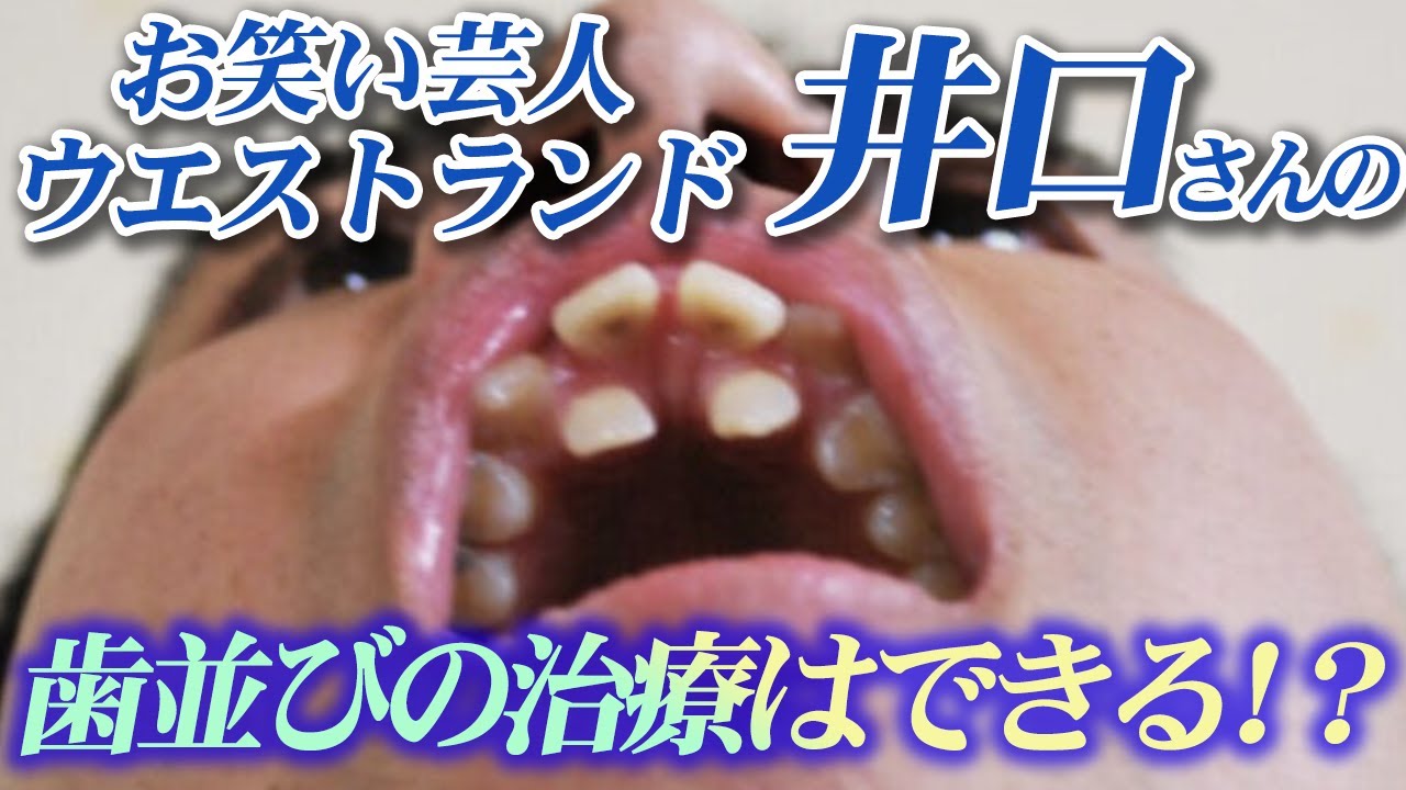 世界 一 歯並び が 悪い 人