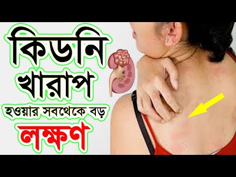 ভিডিও: জেরানসিস এর অর্থ কি?