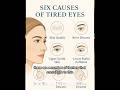Why do my eyes make me look tired? #blepharoplastydenver #eyes #swolleneyes #tiredeyes