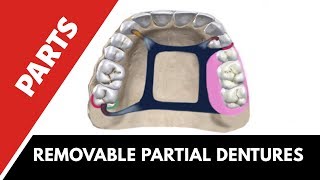 Parts of a cast partial denture | Prosthodontics |