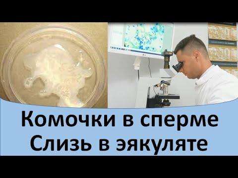 Видео: Густая сперма: эякуляция и другие причины, влияние на фертильность